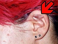 Piercing entzndet